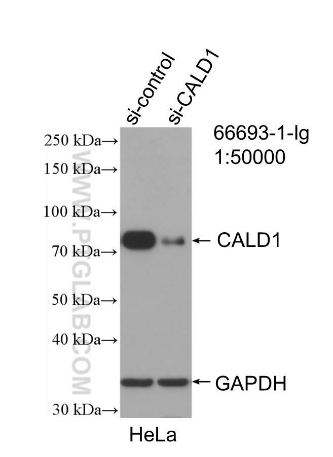 Western Blot (WB) analysis of HeLa cells using CALD1 Monoclonal antibody (66693-1-Ig)