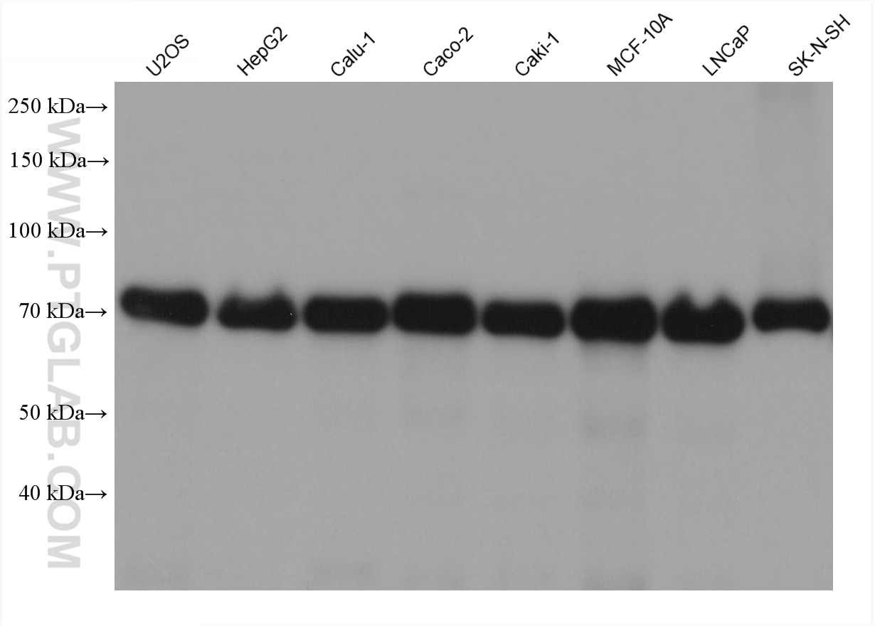 Western Blot (WB) analysis of various lysates using CALD1 Monoclonal antibody (66693-1-Ig)