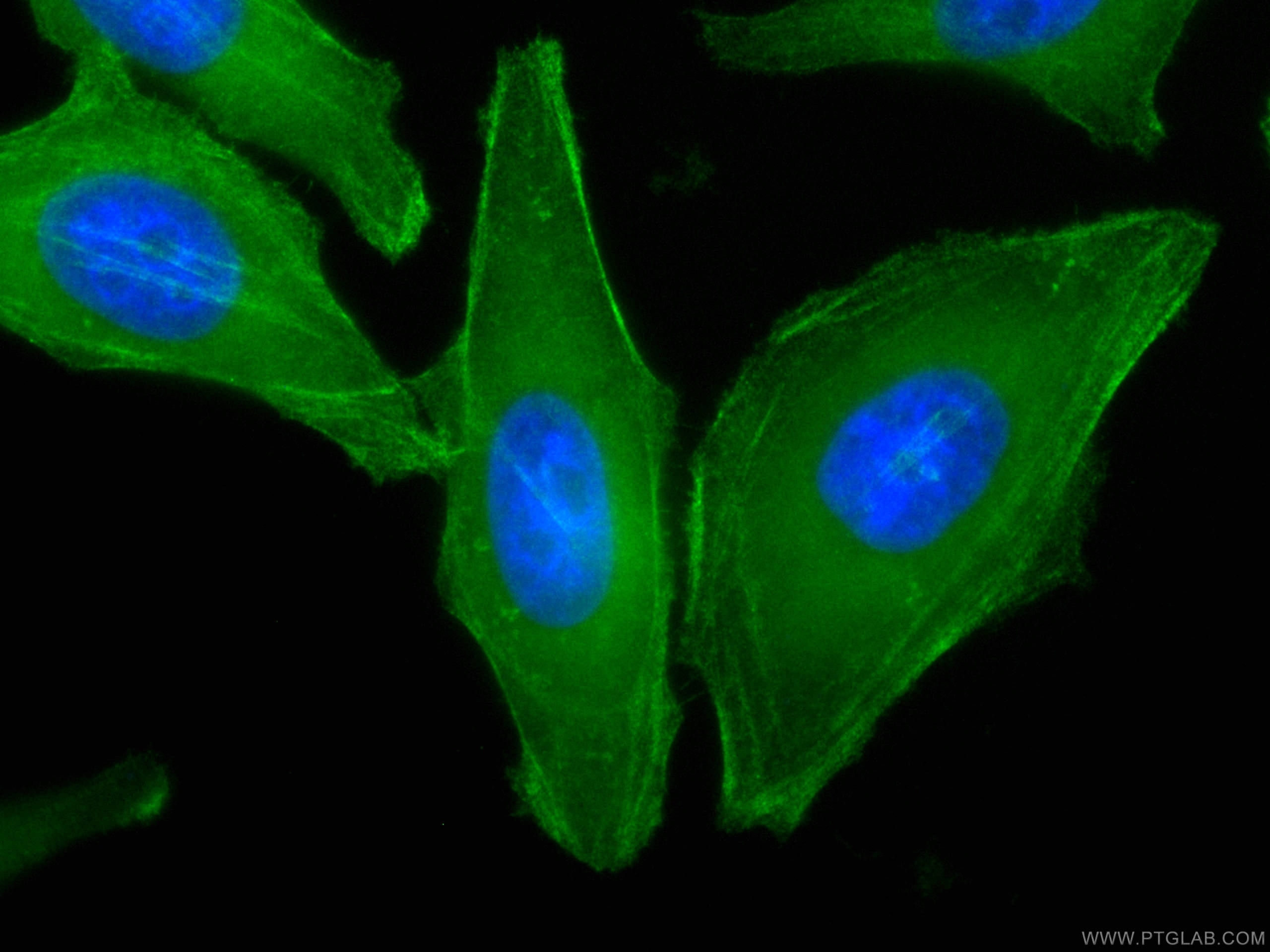 Immunofluorescence (IF) / fluorescent staining of HepG2 cells using CoraLite® Plus 488-conjugated CALD1 Monoclonal ant (CL488-66693)