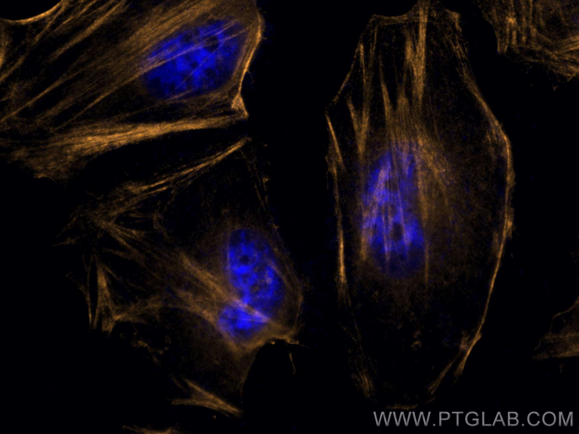 Immunofluorescence (IF) / fluorescent staining of HeLa cells using CoraLite®555-conjugated CALD1 Monoclonal antibody (CL555-66693)