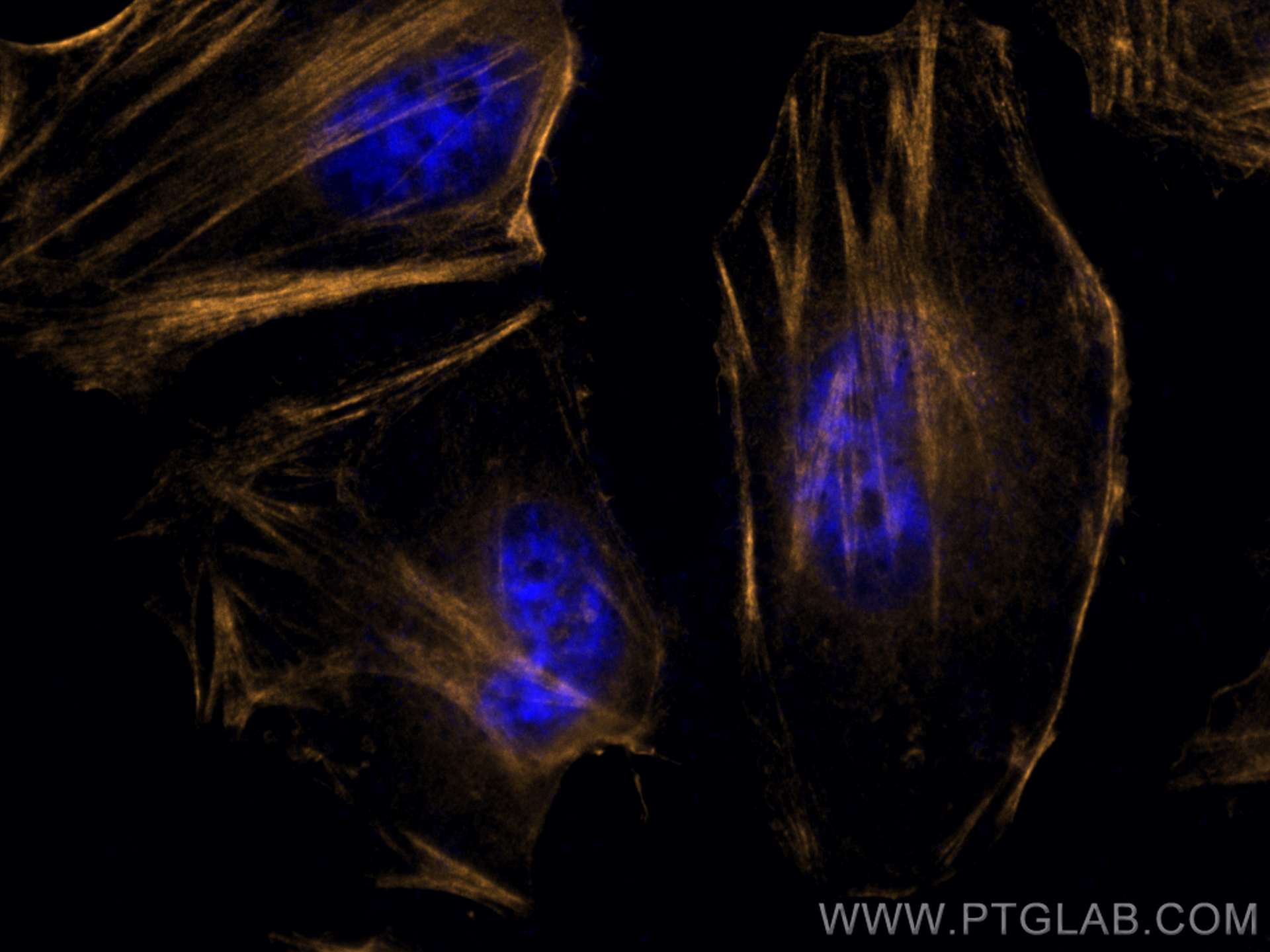 IF Staining of HeLa using CL555-66693