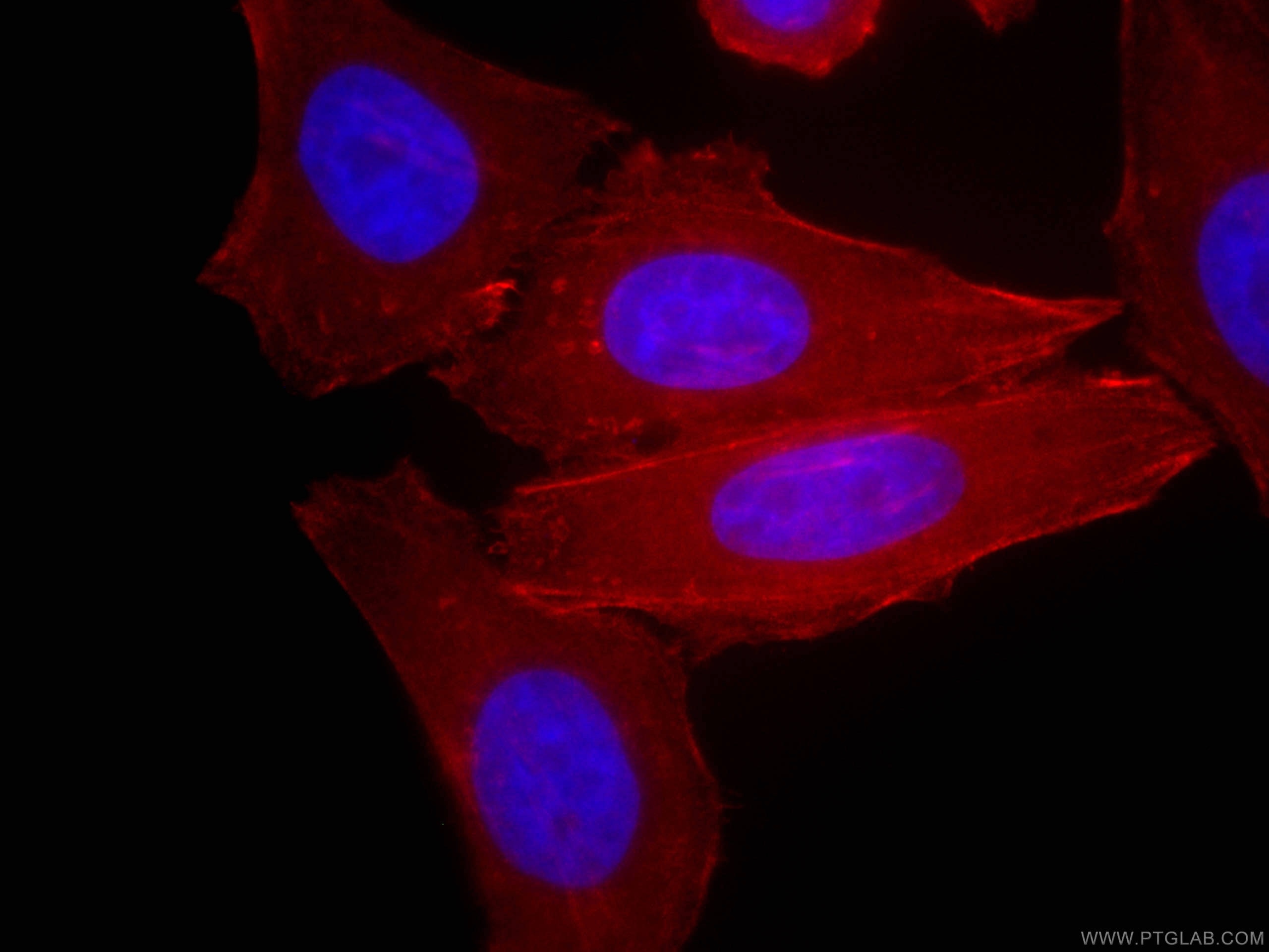 Immunofluorescence (IF) / fluorescent staining of HepG2 cells using CoraLite®594-conjugated CALD1 Monoclonal antibody (CL594-66693)