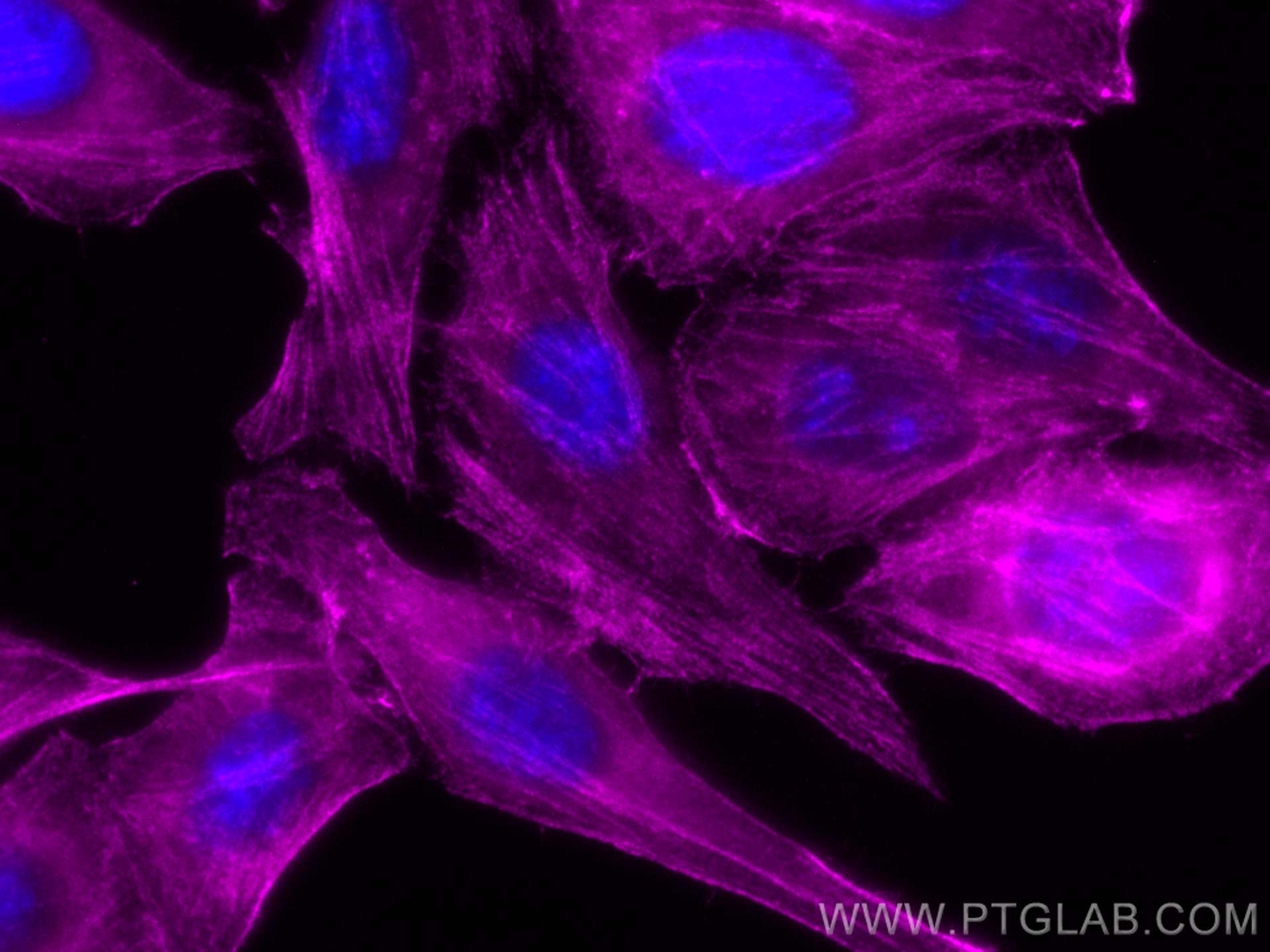 Immunofluorescence (IF) / fluorescent staining of HepG2 cells using CoraLite® Plus 647-conjugated CALD1 Monoclonal ant (CL647-66693)