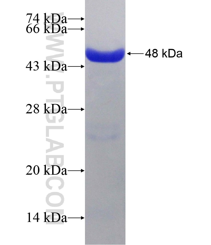 CALD1 fusion protein Ag13676 SDS-PAGE