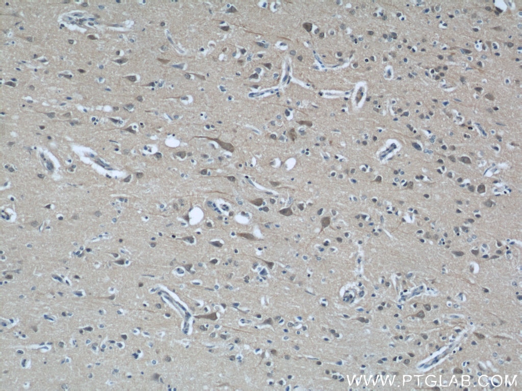 Immunohistochemistry (IHC) staining of human brain tissue using CALHM1 Polyclonal antibody (22042-1-AP)