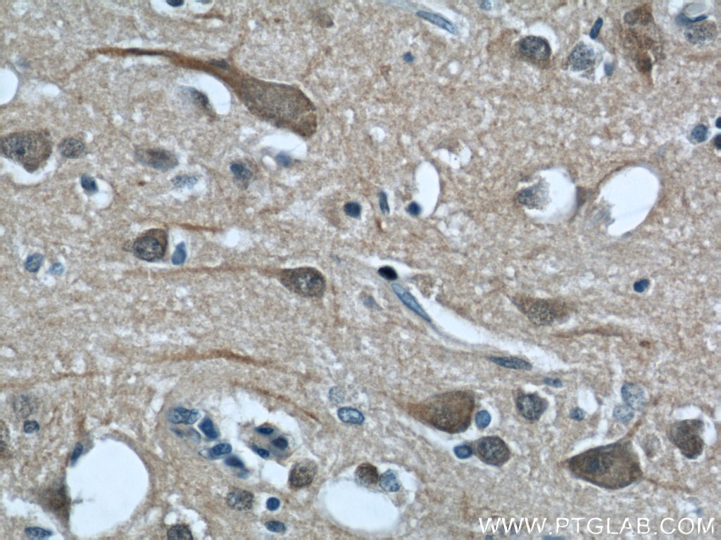 Immunohistochemistry (IHC) staining of human brain tissue using CALHM1 Polyclonal antibody (22042-1-AP)