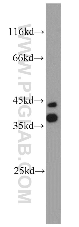 Western Blot (WB) analysis of mouse brain tissue using CALHM1 Polyclonal antibody (22042-1-AP)
