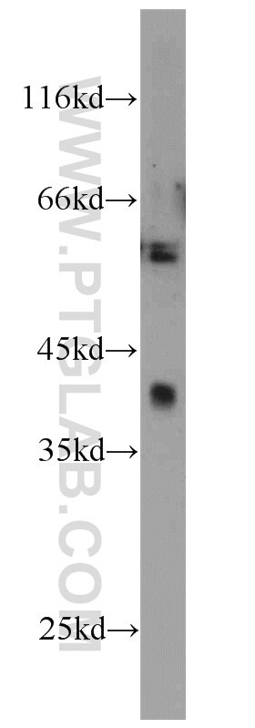 Western Blot (WB) analysis of rat brain tissue using CALHM1 Polyclonal antibody (22042-1-AP)