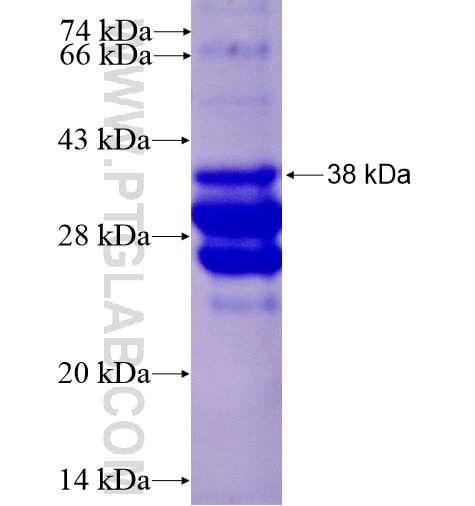 CALHM1 fusion protein Ag14938 SDS-PAGE