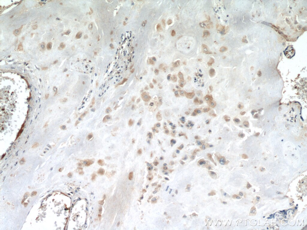 Immunohistochemistry (IHC) staining of human placenta tissue using CALHM2 Polyclonal antibody (19931-1-AP)