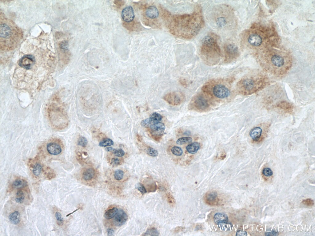 Immunohistochemistry (IHC) staining of human placenta tissue using CALHM2 Polyclonal antibody (19931-1-AP)