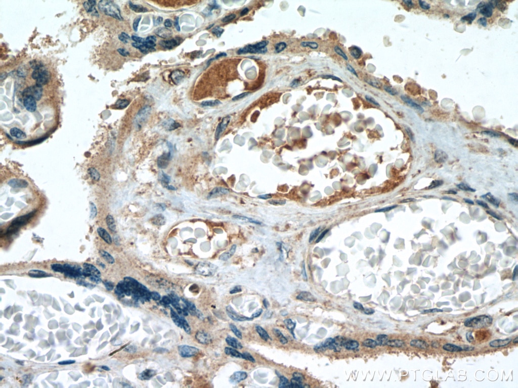 Immunohistochemistry (IHC) staining of human placenta tissue using CALHM2 Polyclonal antibody (19931-1-AP)