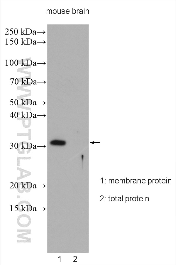 Western Blot (WB) analysis of various lysates using CALHM2 Polyclonal antibody (19931-1-AP)