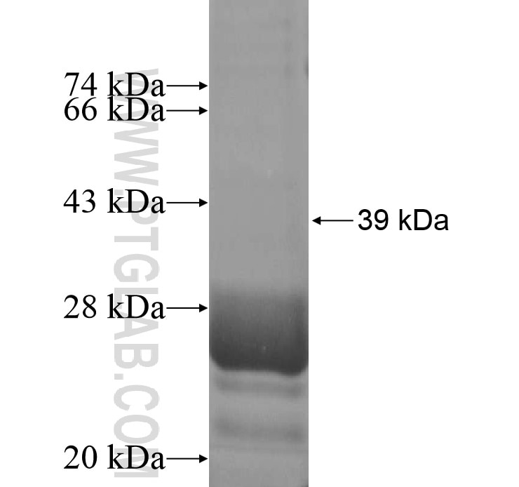 CALHM2 fusion protein Ag13909 SDS-PAGE