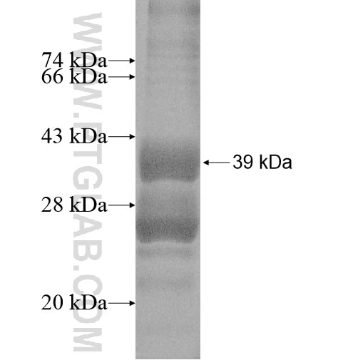 CALHM3 fusion protein Ag14937 SDS-PAGE