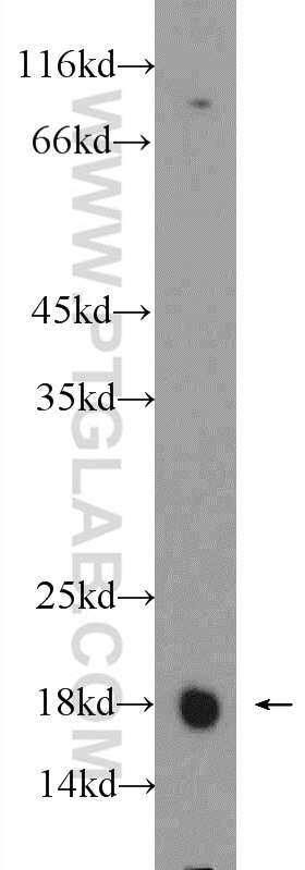 Calmodulin Polyclonal antibody