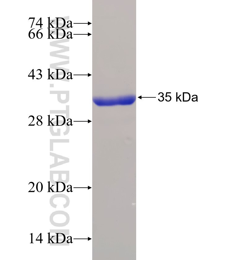 CALM2 fusion protein Ag28000 SDS-PAGE
