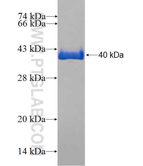 CALM2 fusion protein Ag0820 SDS-PAGE