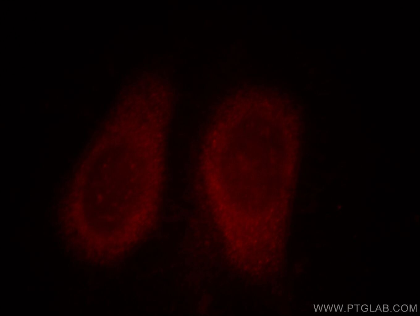 Calmodulin