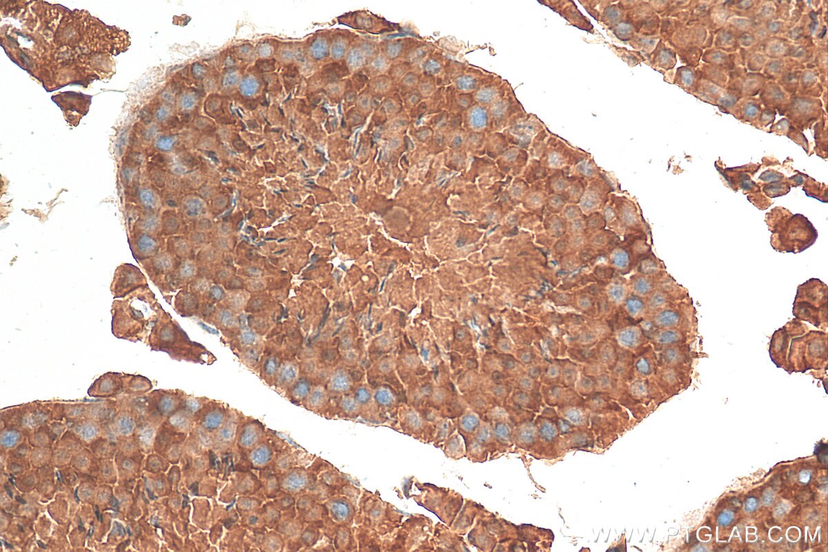 IHC staining of mouse testis using 10541-1-AP