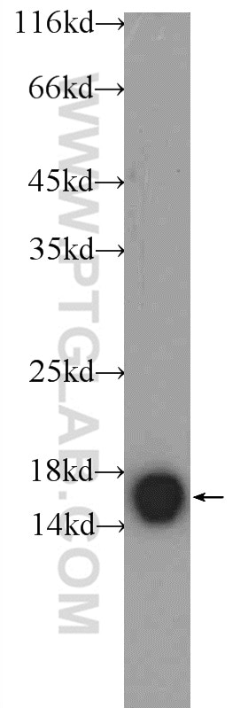 WB analysis of mouse brain using 10541-1-AP