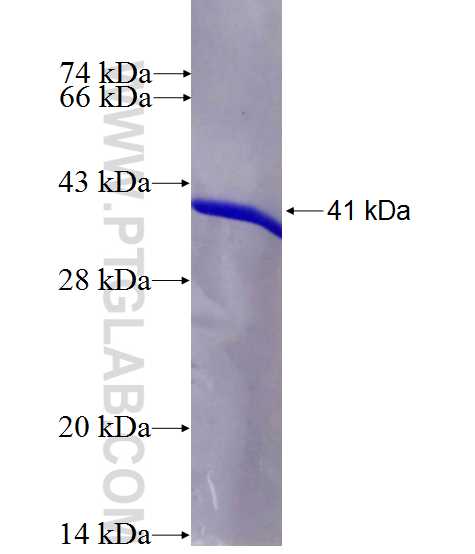 CALM3 fusion protein Ag0146 SDS-PAGE