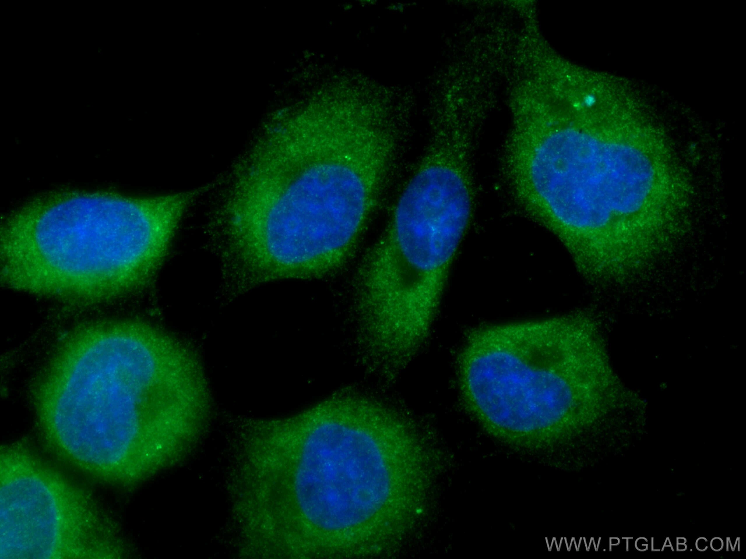 Immunofluorescence (IF) / fluorescent staining of A431 cells using CALML3 Polyclonal antibody (17275-1-AP)