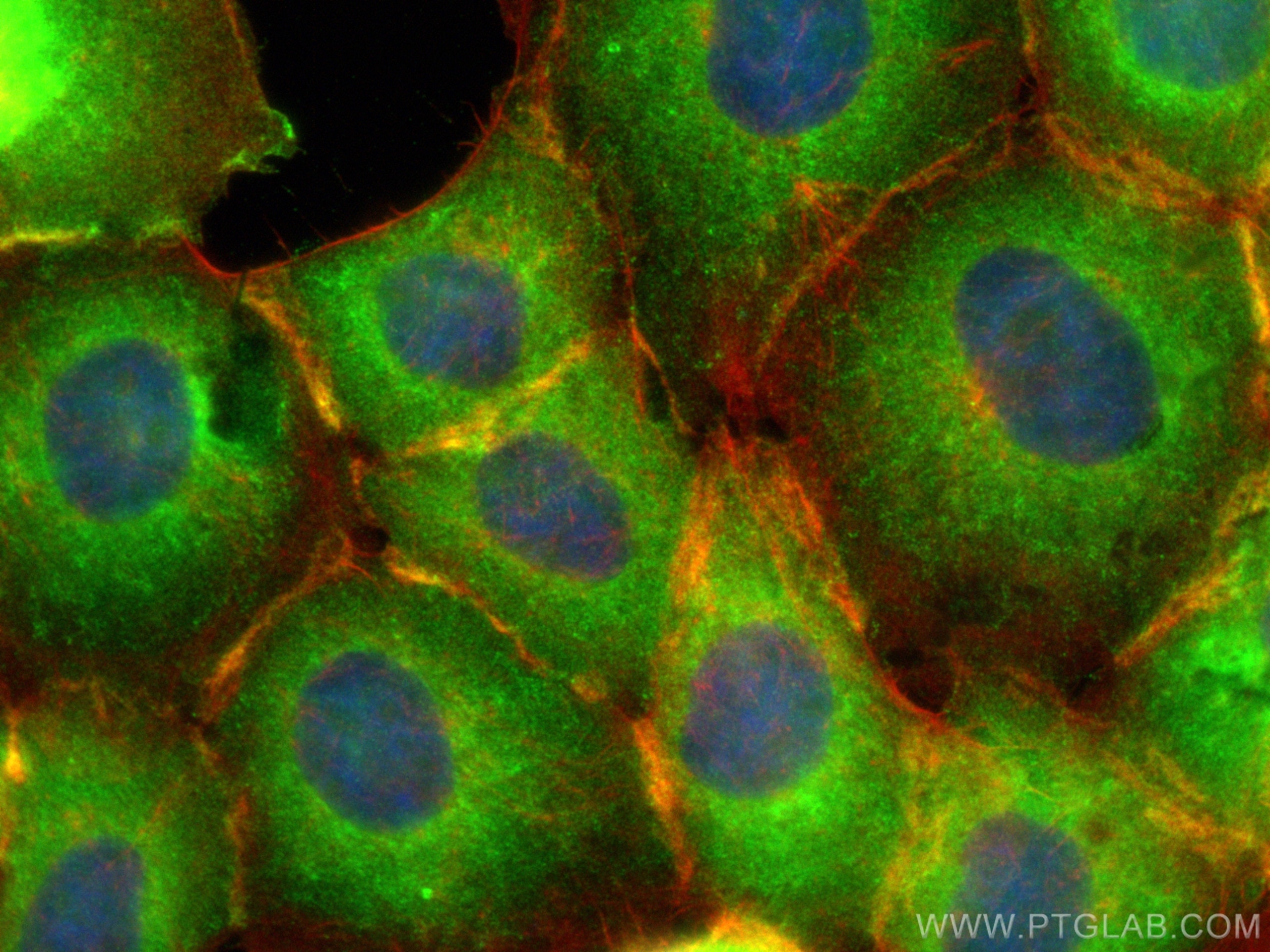Immunofluorescence (IF) / fluorescent staining of A431 cells using CALML3 Polyclonal antibody (17275-1-AP)