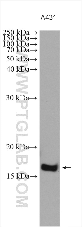 Western Blot (WB) analysis of various lysates using CALML3 Polyclonal antibody (17275-1-AP)