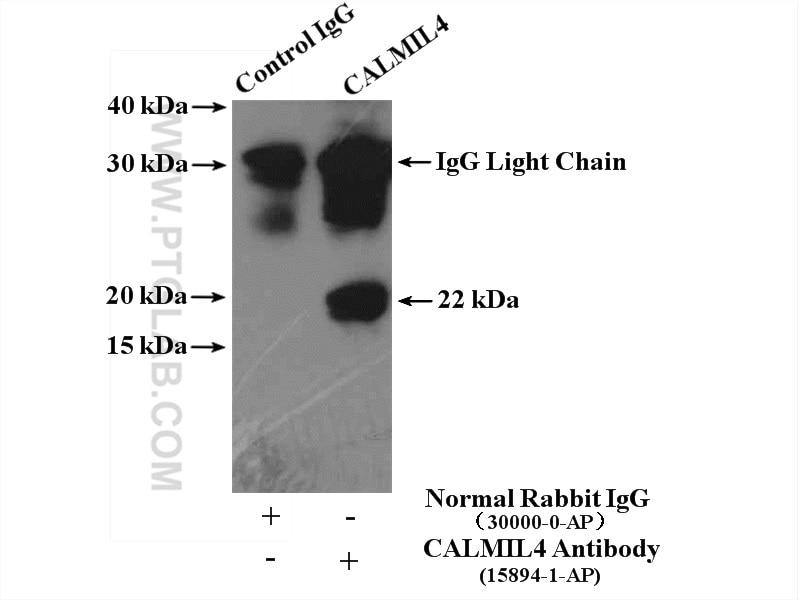 Immunoprecipitation (IP) experiment of mouse thymus tissue using CALML4 Polyclonal antibody (15894-1-AP)