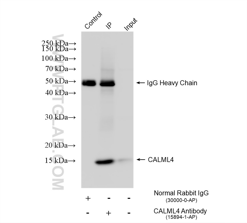 Immunoprecipitation (IP) experiment of rat kidney tissue using CALML4 Polyclonal antibody (15894-1-AP)