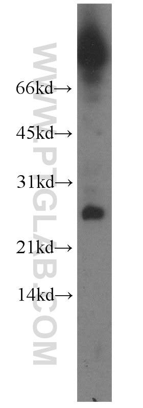 Western Blot (WB) analysis of mouse thymus tissue using CALML4 Polyclonal antibody (15894-1-AP)