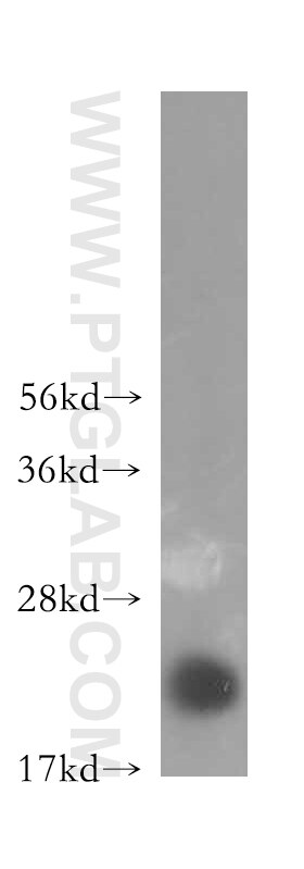 Western Blot (WB) analysis of human colon tissue using CALML4 Polyclonal antibody (15894-1-AP)