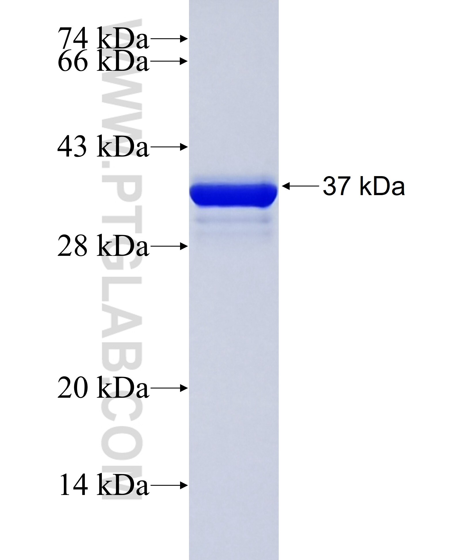 CALML5 fusion protein Ag29716 SDS-PAGE CALML5 fusion protein Ag29716 SDS-PAGE