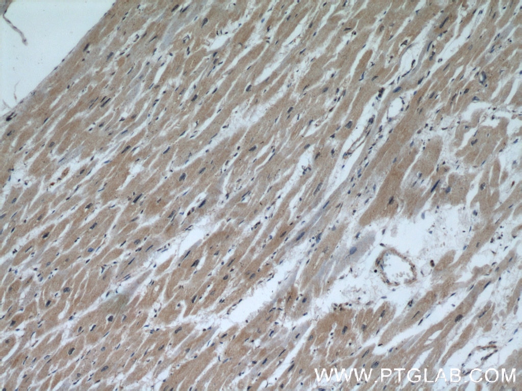 Immunohistochemistry (IHC) staining of human heart tissue using CALML6 Polyclonal antibody (22274-1-AP)