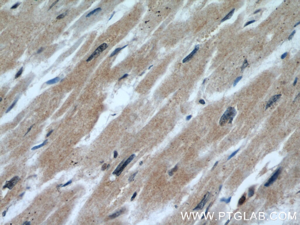 Immunohistochemistry (IHC) staining of human heart tissue using CALML6 Polyclonal antibody (22274-1-AP)