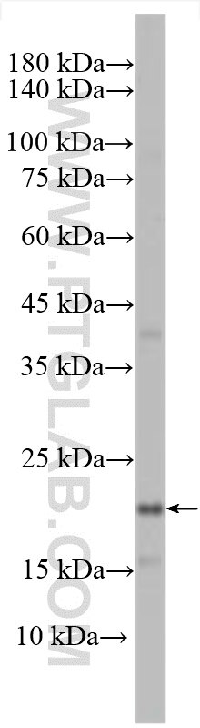 Western Blot (WB) analysis of pig heart tissue using CALML6 Polyclonal antibody (22274-1-AP)