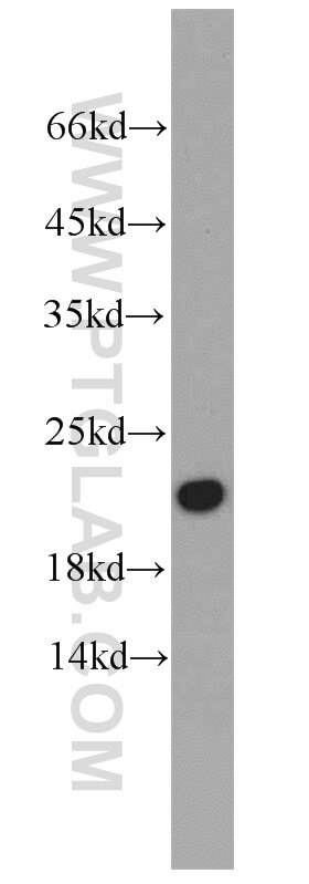 Western Blot (WB) analysis of human heart tissue using CALML6 Polyclonal antibody (22274-1-AP)