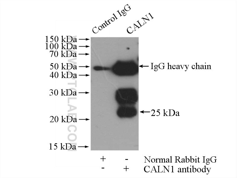 IP experiment of rat brain using 11477-1-AP