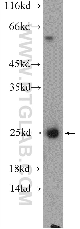 WB analysis of rat brain using 11477-1-AP