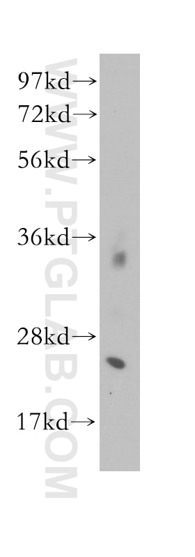 Western Blot (WB) analysis of human brain tissue using CALN1 Polyclonal antibody (11477-1-AP)