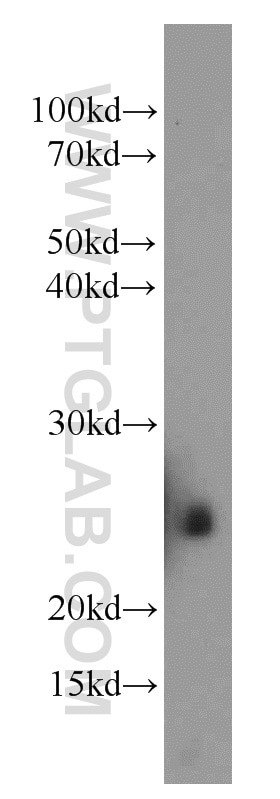 Western Blot (WB) analysis of mouse brain tissue using CALN1 Polyclonal antibody (11477-1-AP)