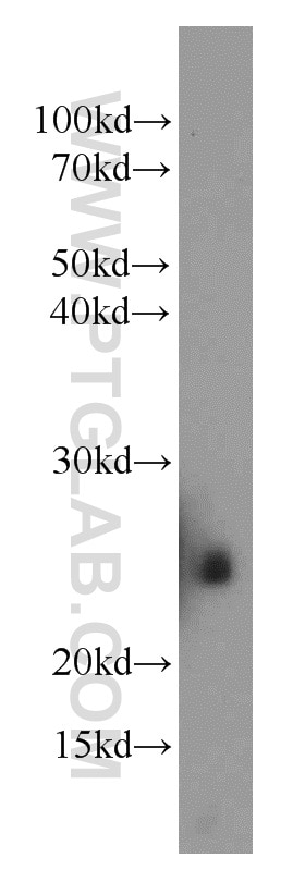 WB analysis of mouse brain using 11477-1-AP