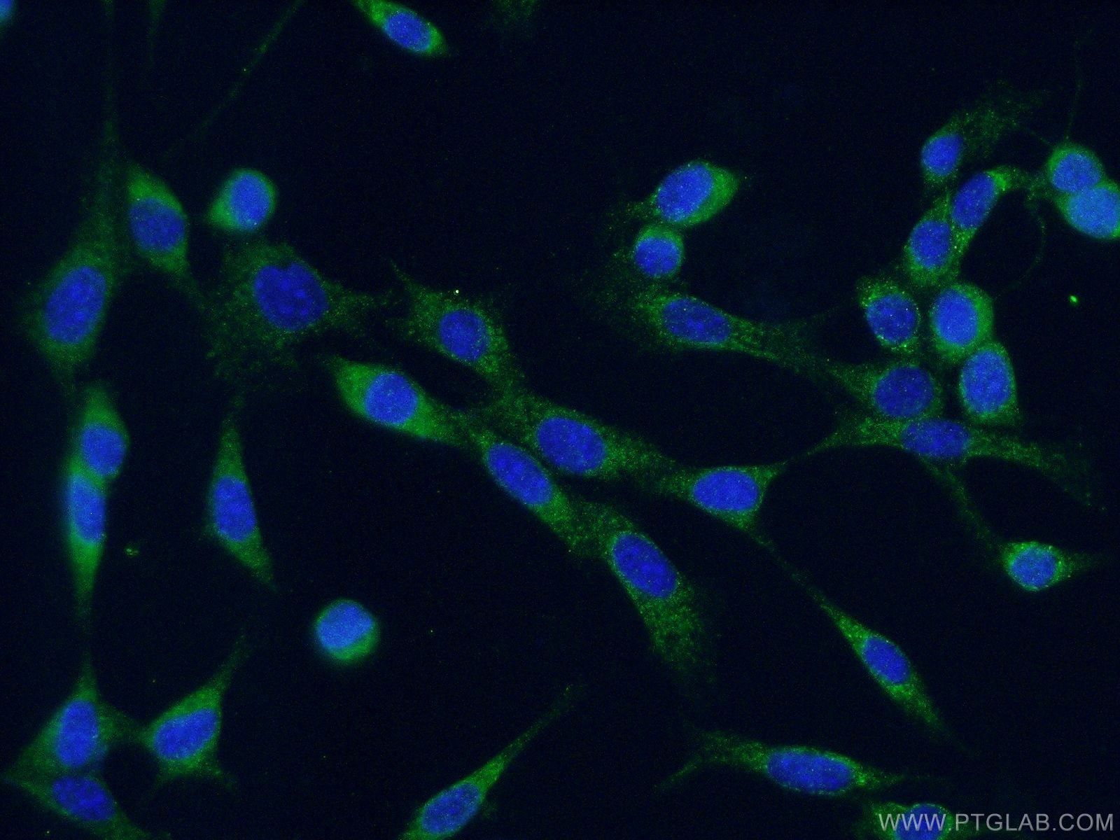 calreticulin Polyclonal antibody