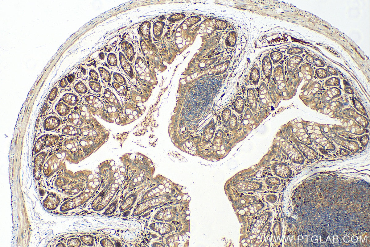 Immunohistochemistry (IHC) staining of mouse colon tissue using calreticulin Polyclonal antibody (10292-1-AP)
