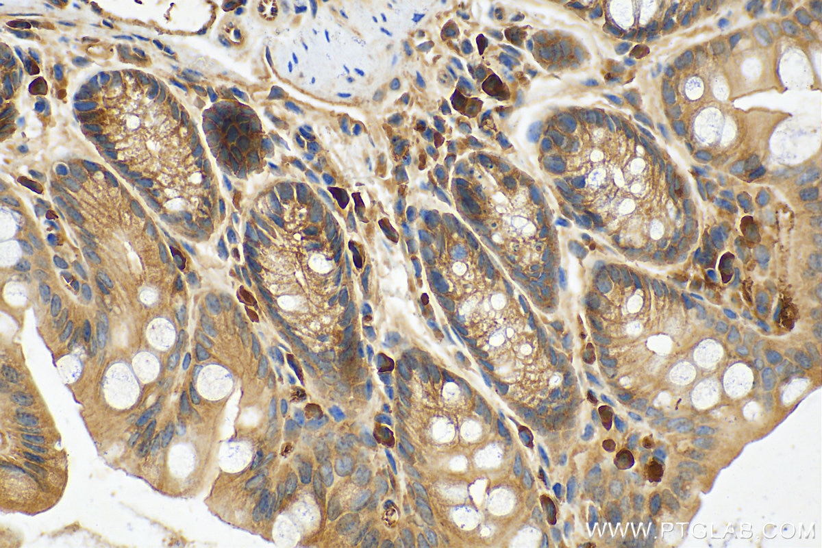 Immunohistochemistry (IHC) staining of mouse colon tissue using calreticulin Polyclonal antibody (10292-1-AP)