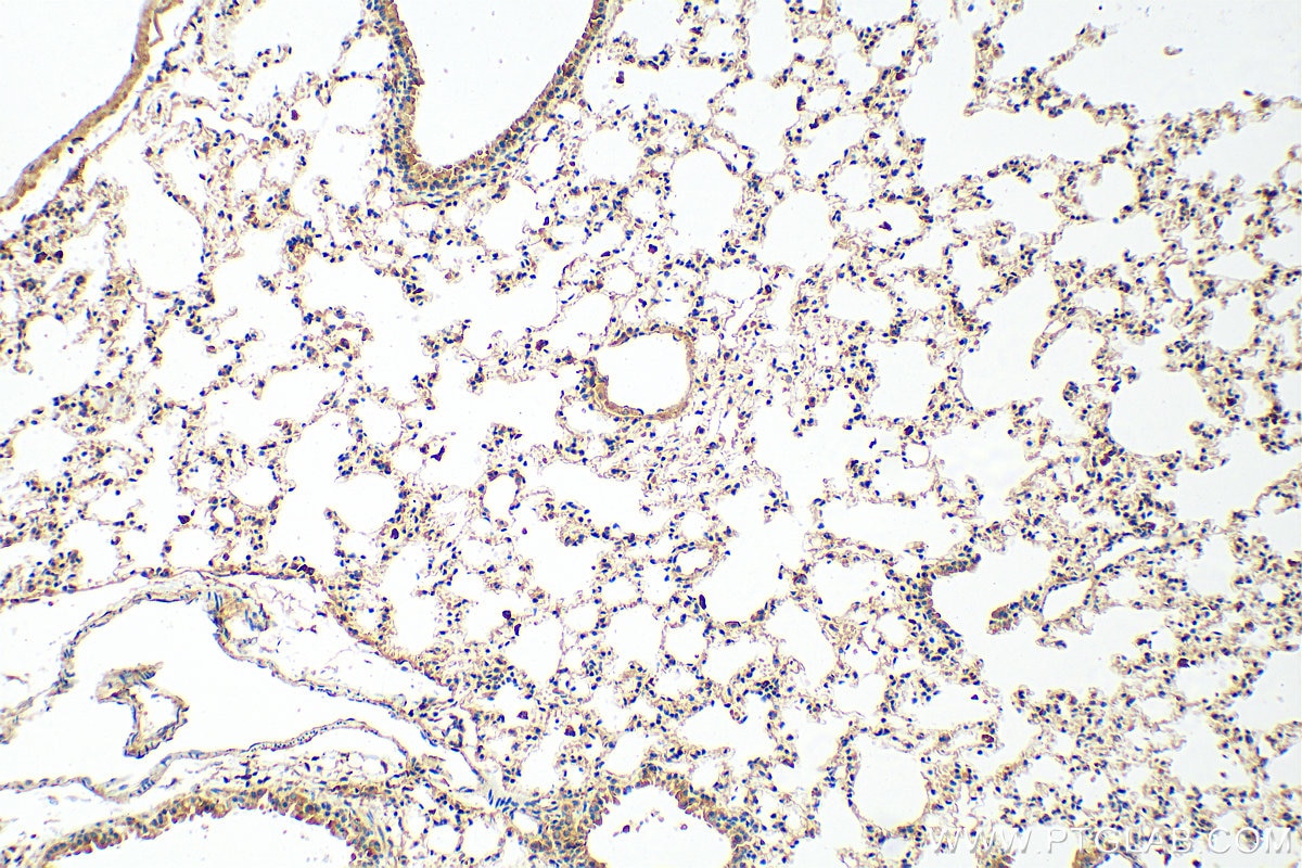Immunohistochemistry (IHC) staining of mouse lung tissue using calreticulin Polyclonal antibody (10292-1-AP)