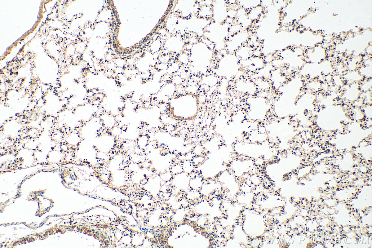 IHC staining of mouse lung using 10292-1-AP