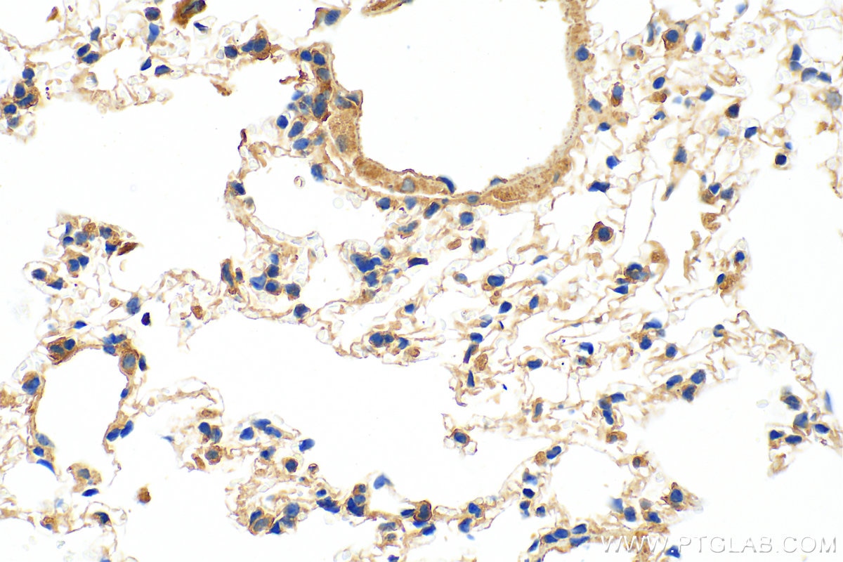 Immunohistochemistry (IHC) staining of mouse lung tissue using calreticulin Polyclonal antibody (10292-1-AP)