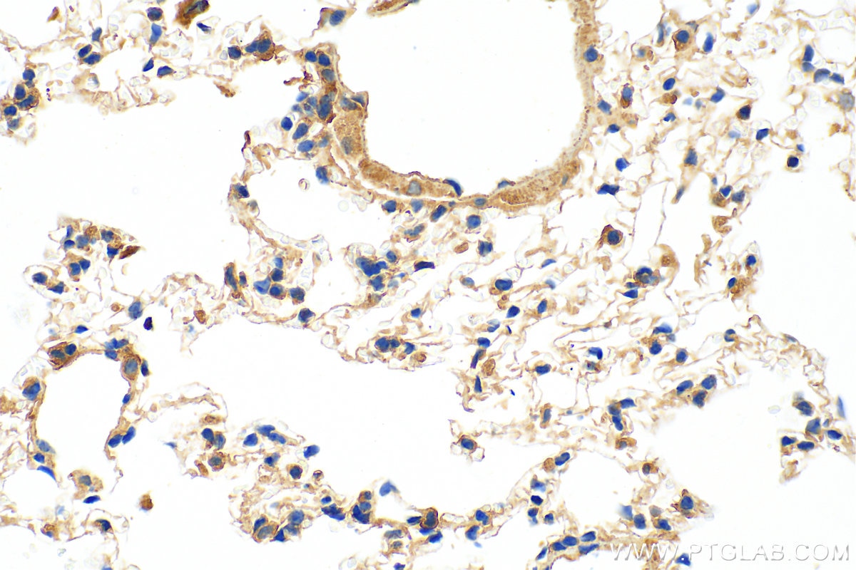 IHC staining of mouse lung using 10292-1-AP